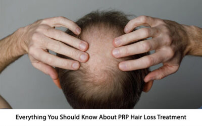 Everything You Should Know About PRP Hair Loss Treatment