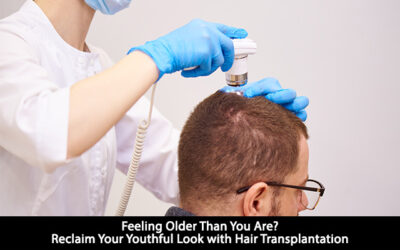 Feeling Older Than You Are? Reclaim Your Youthful Look with Hair Transplantation